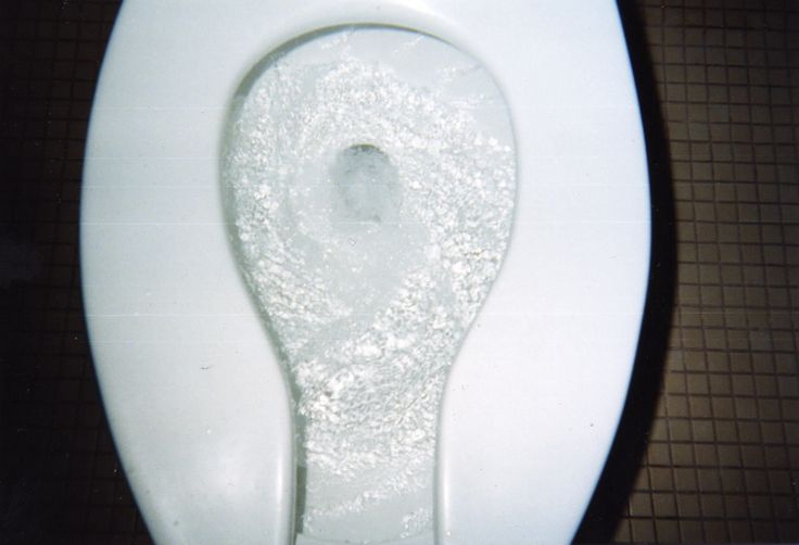 Add a cup of baking soda to the toilet, leave it for an hour, and then flush.  It will clean the toilet and absorb the odor.  This site also has 75 other uses for baking soda!